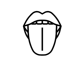 frenectomy labial lingual tongue tie lip tie